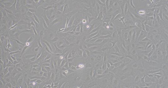 Human Ovarian Carcinoma Cells (OCC)