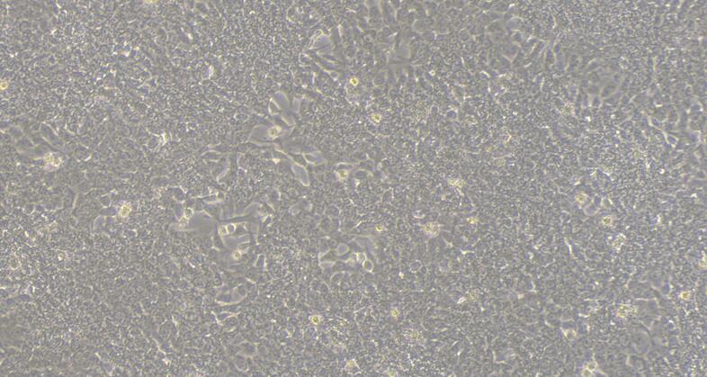 Human Colon Carcinoma Cells (CCC)