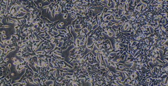 Human Colon Carcinoma Cells (CCC)
