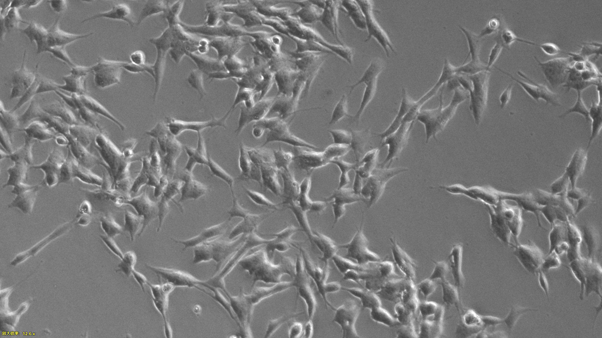 Human Neuroblastoma Cells (NBC)