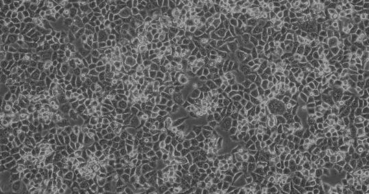 Human Breast Cancer Cells (BCC)