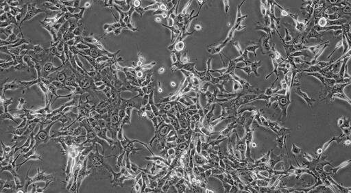 Mouse Breast Cancer Cells (BCC)