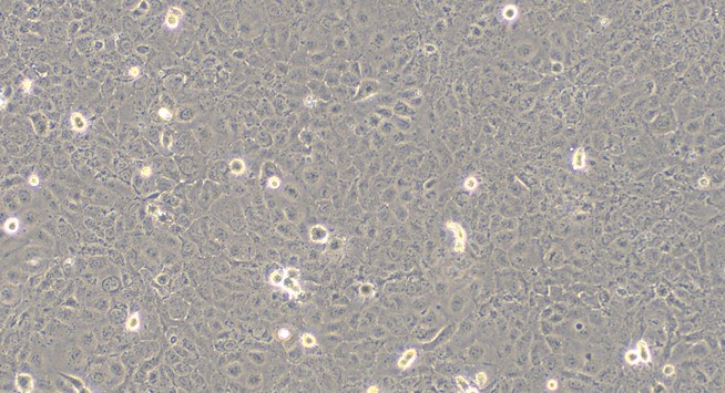Human Prostate Cancer Cells (PCC)
