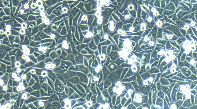 Human Prostate Cancer Cells (PCC)