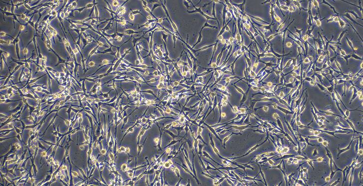 Rat Pheochromocytoma Cells (PCC)