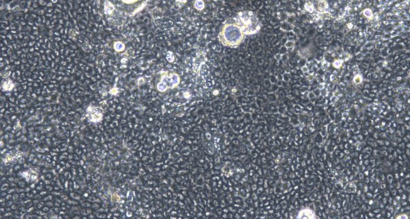 Human Gastric Cancer Cells (GCC)