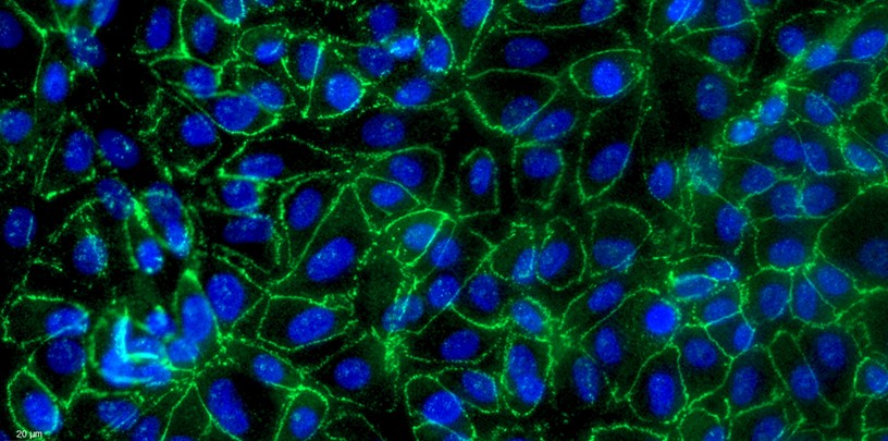 Primary Gallus Embryonic Kidney Epithelial Cells (EKE)