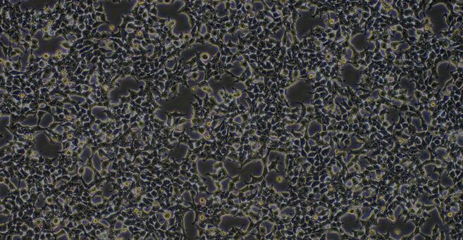 Human Embryonic Kidney Epithelial Cells (EKE)