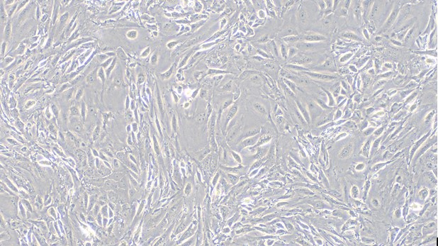 Primary Mouse Embryonic Kidney Epithelial Cells (EKE)