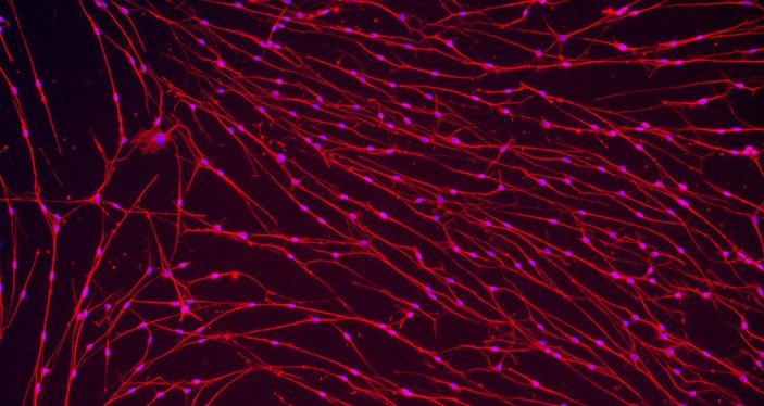 Primary Mouse Trigeminal ganglion neuron cells (TGN)