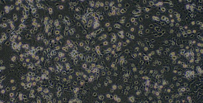 Primary Rat Spinal Cord Neuron Cells (SCN)