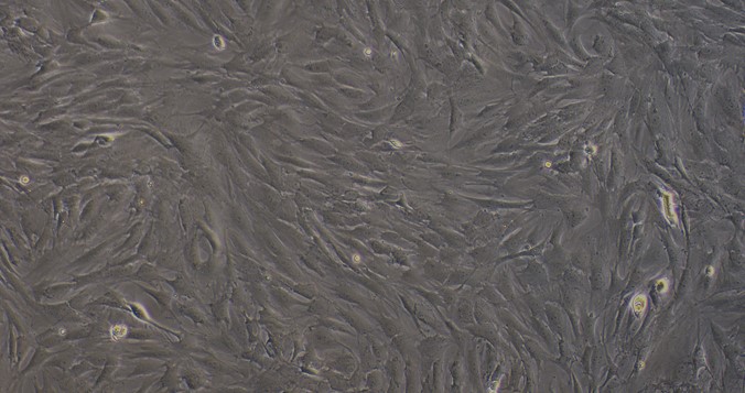 Primary Rat Skeletal Muscle Fibroblasts (SMF)