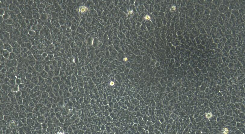Primary Mouse Placental Mesenchymal Stem Cells (PMSC)