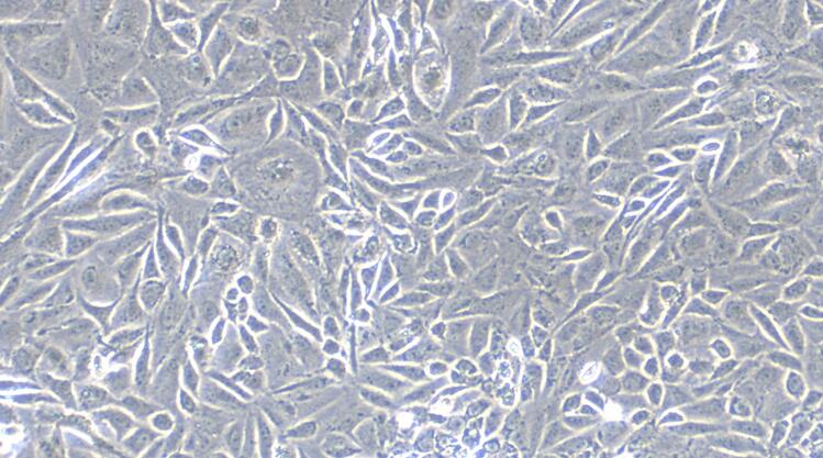 Primary Mouse Ovarian Granulosa Cells (OGC)