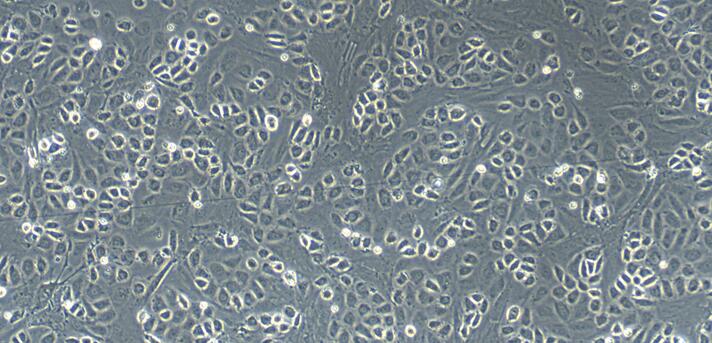 Primary Rat Peritoneal Mesothelial Cells (PMC)