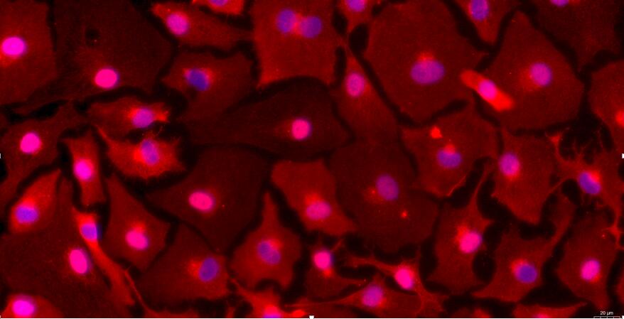 Primary Rabbit Peritoneal Mesothelial Cells (PMC)