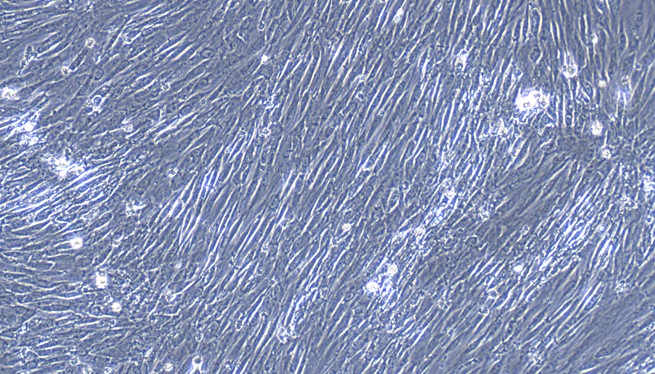 Primary Feline Ureteral Smooth Muscle Cells (USMC)
