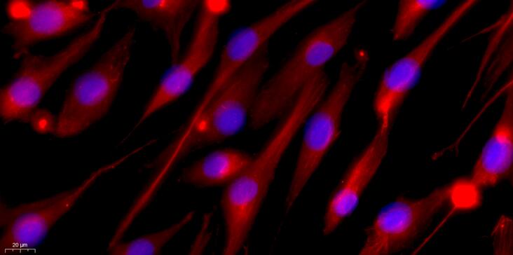 Primary Canine Corneal Stromal cells (CSC)