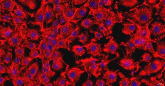 Primary Mouse Corneal Stromal cells (CSC)