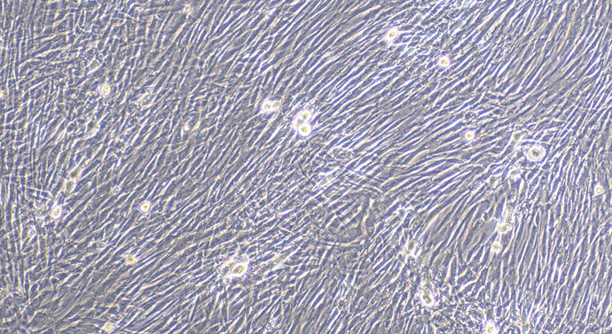 Primary Rabbit Epididymis Fibroblasts (EF)