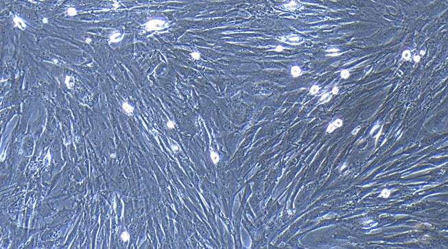 Primary Mouse Pancreatic Fibroblasts (PNF)