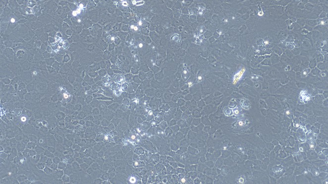 Primary Mouse Auricular Chondrocytes (ACC)