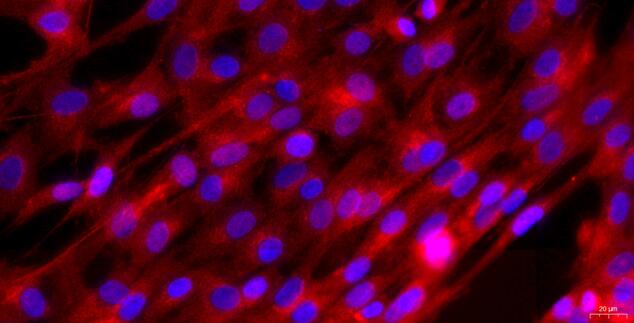 Primary Canine Corpus Cavernosum Smooth Muscle Cells (CCSM)