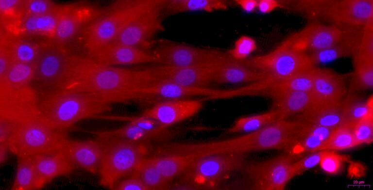 Primary Caprine Corpus Cavernosum Smooth Muscle Cells (CCSM)