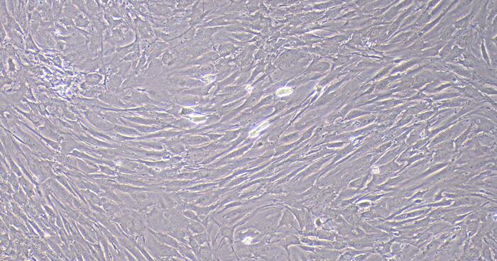 Primary Rat Corpus Cavernosum Smooth Muscle Cells (CCSM)