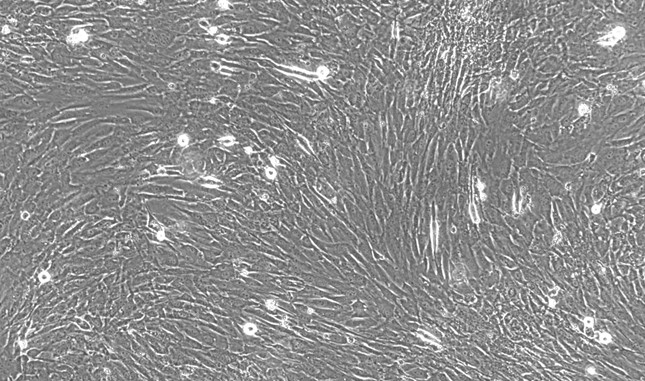 Primary Mouse Oral Mucosal Fibroblasts (OMF)