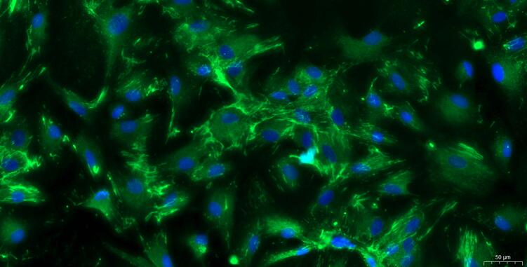 Primary Rat Oral Mucosal Fibroblasts (OMF)