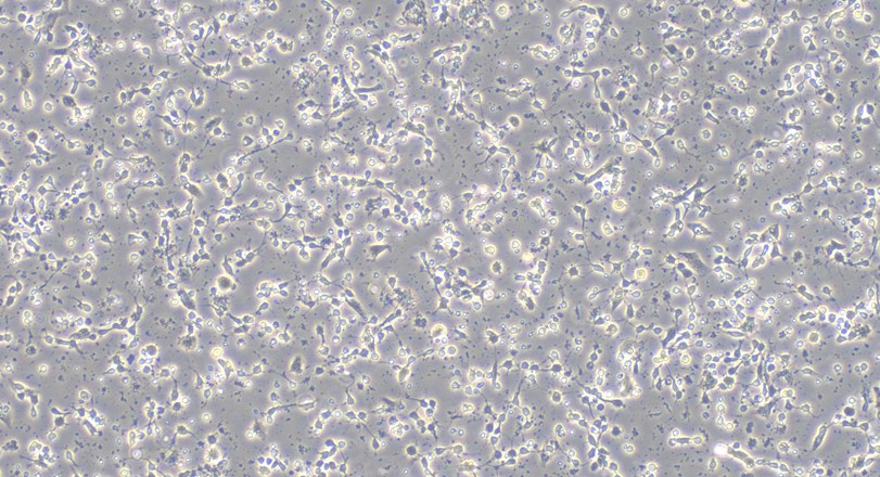 Primary Mouse Cerebral Cortex Neuron Cells (CCNC)