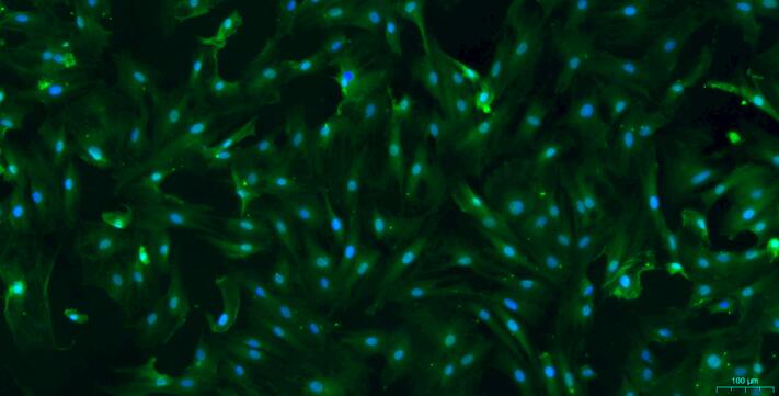 Primary Rat Urothelial Smooth Muscle Cells (USMC)