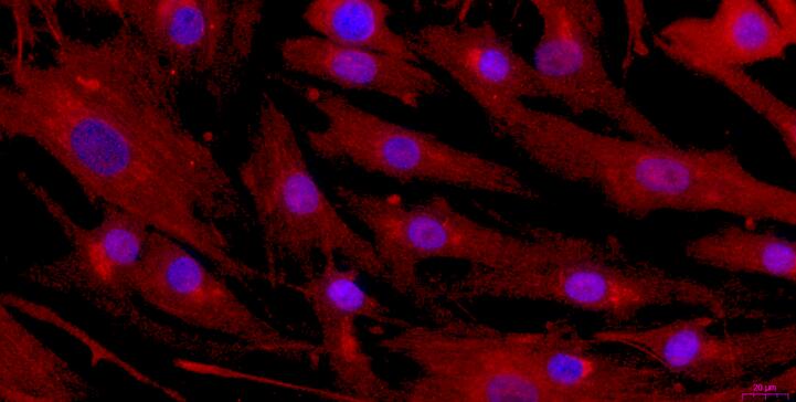 Primary Rabbit Urothelial Smooth Muscle Cells (USMC)