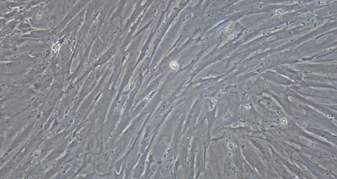 Primary Rat Vas Deferens Smooth Muscle Cells (VDSM)