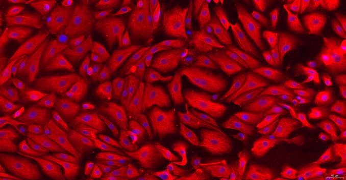Primary Canine Vas Deferens Epithelial Cells (VDEC)