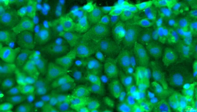 Primary Mouse Fallopian Tube Epithelial Cells (FTEC)