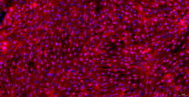 Primary Canine Tracheal Chondrocytes (TrC)