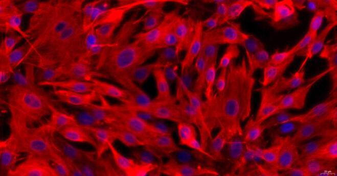 Primary Rabbit Cardiac Valve Interstitial Cells (CVIC)
