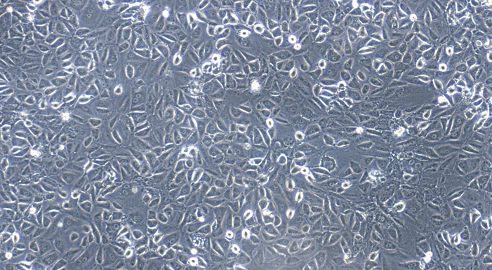 Primary Feline Pericardial Mesothelial Cells (PeMC)