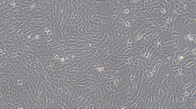 Primary Rat Inferior Vena Cava Smooth Muscle Cells ( IVCSMC)