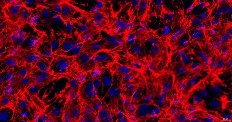 Primary Rat Endocardial Fibroblasts (EnCF)