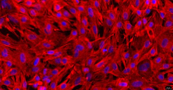 Primary Rabbit Endocardial Fibroblasts (EnCF)