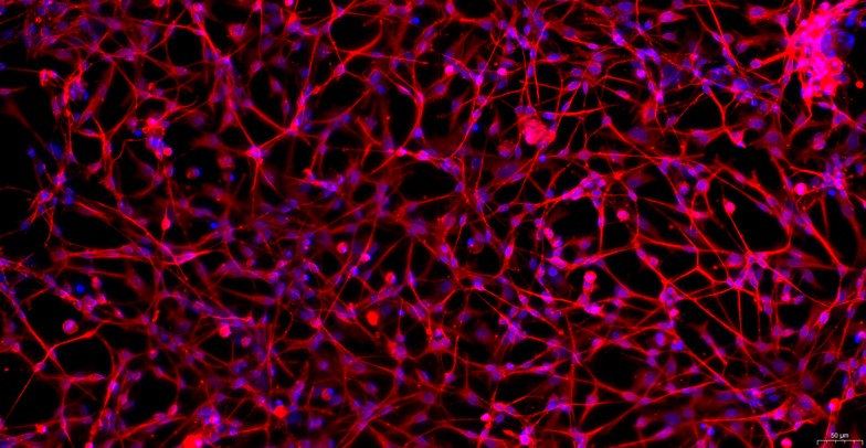 Primary Canine Dorsal Root Ganglion Neuron Cells (DRGN)