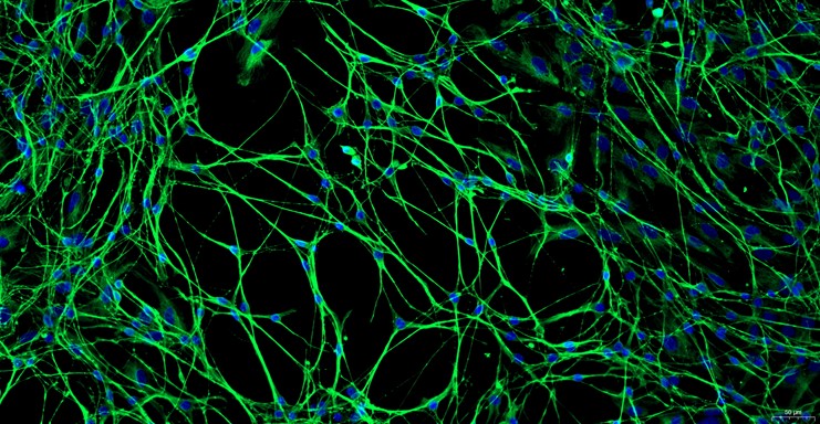 Primary Mouse Dorsal Root Ganglion Neuron Cells (DRGN)