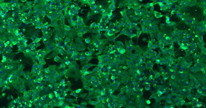 Primary Mouse Seminal Vesicle Smooth Muscle Cells (SVSMC)