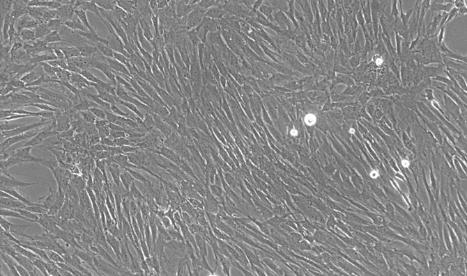 Primary Rat Seminal Vesicle Smooth Muscle Cells (SVSMC)