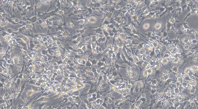 Primary Mouse Olfactory Bulb Neuron Cells (OBNC)
