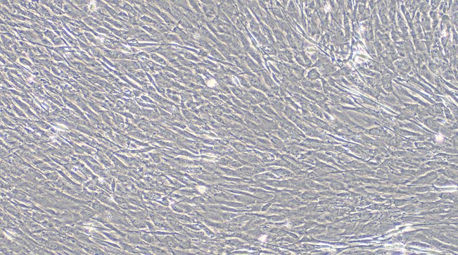 Primary Rat Peripheral Sciatic Nerve Fibroblasts ( PSNC)