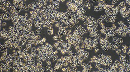 Mouse RAW264.7 Monocytic Macrophage Leukemia Cells (RAW264.7)